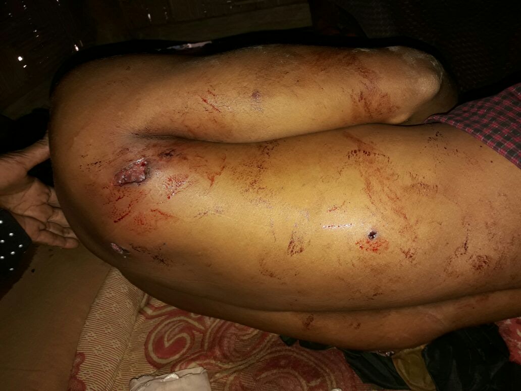 قناص ميانماري يودي بحياة رجل روهنغي ويترك آخرين في حالات حرجة
