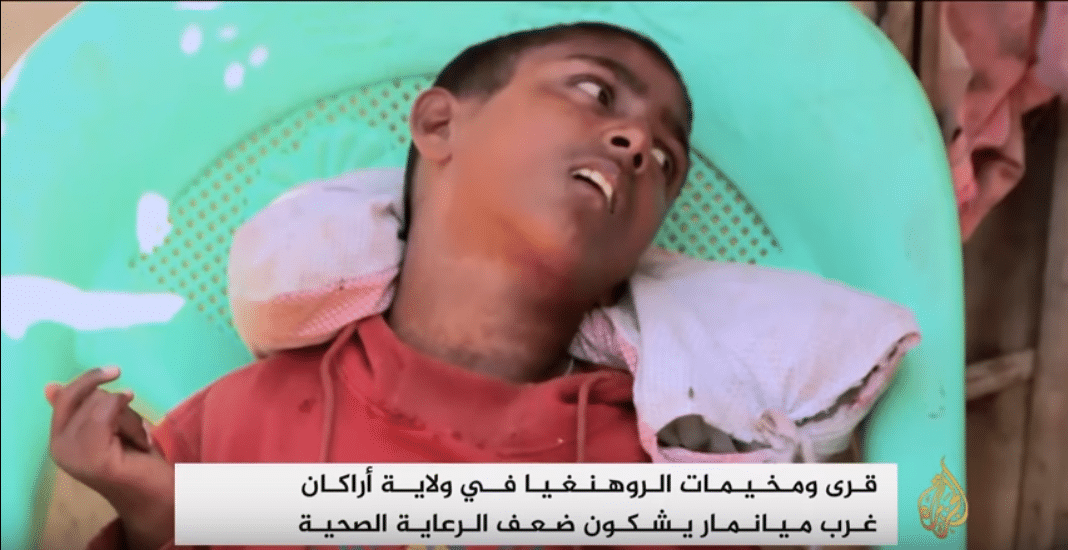 مخيمات الروهنغيا تشكو ضعف الرعاية الصحية