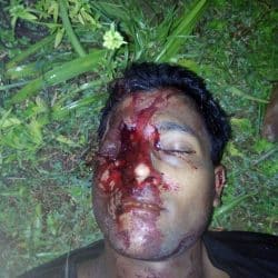 عاجل: حملات قتل وإحراق لقرى الروهنغيا ينفذها جيش ميانمار الآن