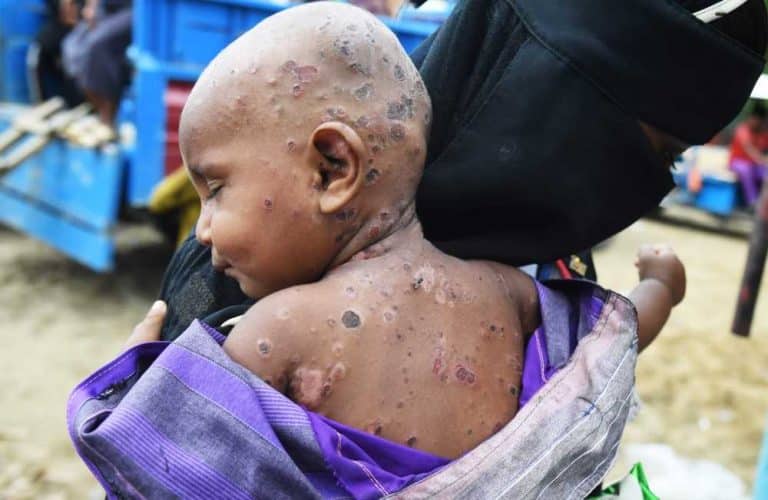 نيويورك تايمز : بوذيو ميانمار يكنون الحقد لأقلية الروهنغيا المسلمة
