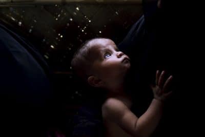 صور.. سوء التغذية يهدد حياة أطفال الروهنغيا في مخيمات بنغلادش