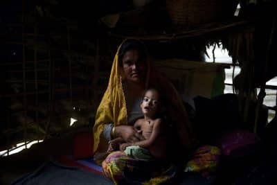 صور.. سوء التغذية يهدد حياة أطفال الروهنغيا في مخيمات بنغلادش