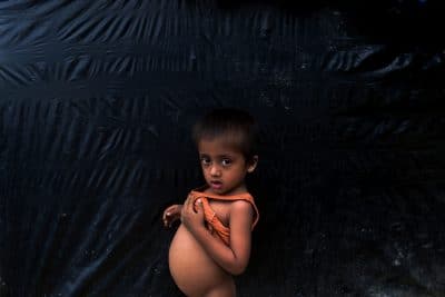 صور.. سوء التغذية يهدد حياة أطفال الروهنغيا في مخيمات بنغلادش