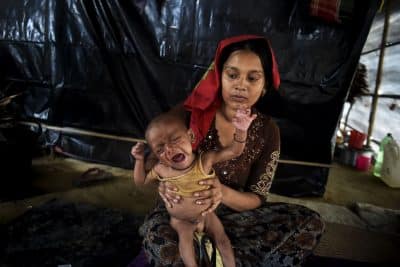 صور.. سوء التغذية يهدد حياة أطفال الروهنغيا في مخيمات بنغلادش