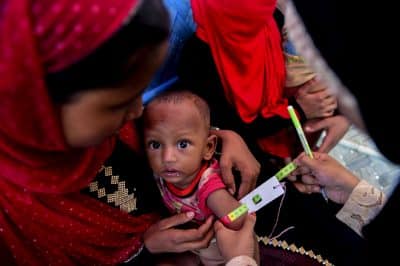 صور.. سوء التغذية يهدد حياة أطفال الروهنغيا في مخيمات بنغلادش
