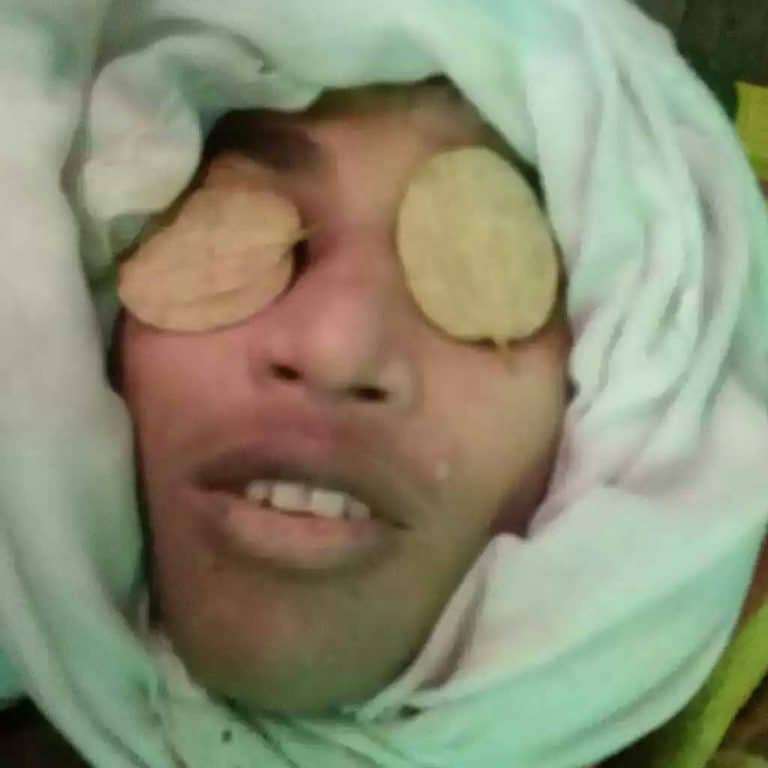 ميانمار تقتل طفلا روهنغيا بعد اعتقاله وتسلمه لذويه