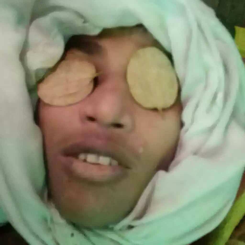 ميانمار تقتل طفلا روهنغيا بعد اعتقاله وتسلمه لذويه