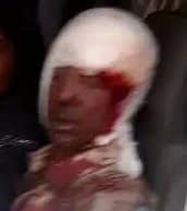 اعتداء بوذي متطرف على رجل روهنغي بالساطور يلحق به إصابات بليغة