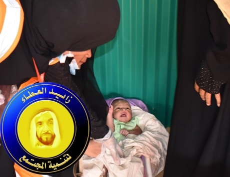 ولادة أول مولودة من اللاجئين الروهنغيا في مستشفى زايد الانساني
