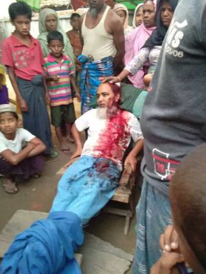 متطرفون بوذيون يشجون رأس خمسيني روهنغي في أراكان