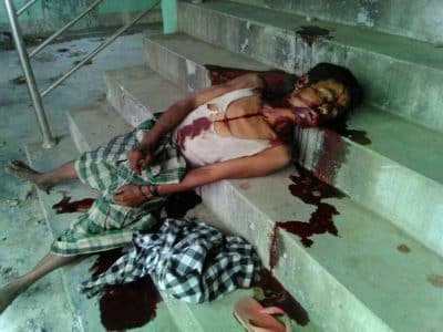 مجهولون يقتلون مسلما روهنغيا بطريقة بشعة واتهامات تطال الشرطة