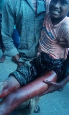 رصاصات الجيش الميانماري تلاحق الروهنغيا إلى بنغلادش وتصيب طفلا