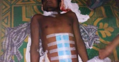 أسرة روهنغية تتهم مستشفى في بنغلادش بقتل وسرقة أعضاء ابنهم