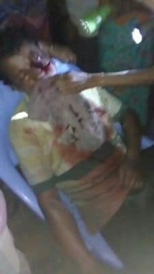 جندي ميانماري يطعن روهنغيا في وجهه