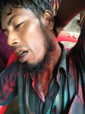 اعتداء بوذي على رجل مسلم يسفر عن جروح عميقة بالرأس