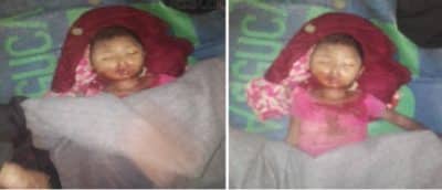 سيارة إسعاف تدهس طفلة روهنغية وتفر من المكان في بنغلادش