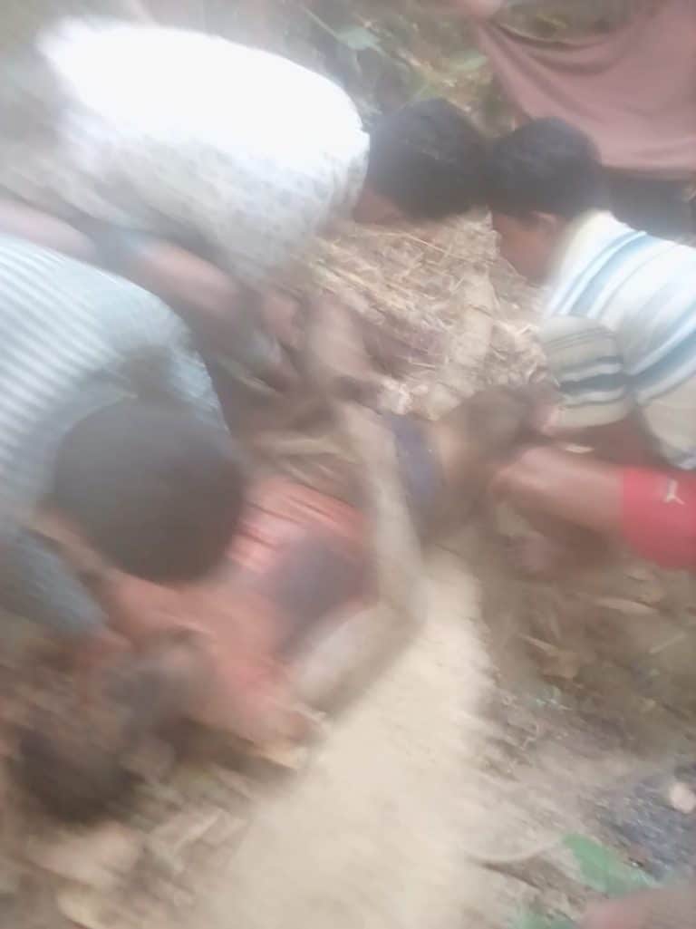 نزف حتى الموت .. لغم أرضي يودي بحياة لاجئ روهنغي في بنغلادش