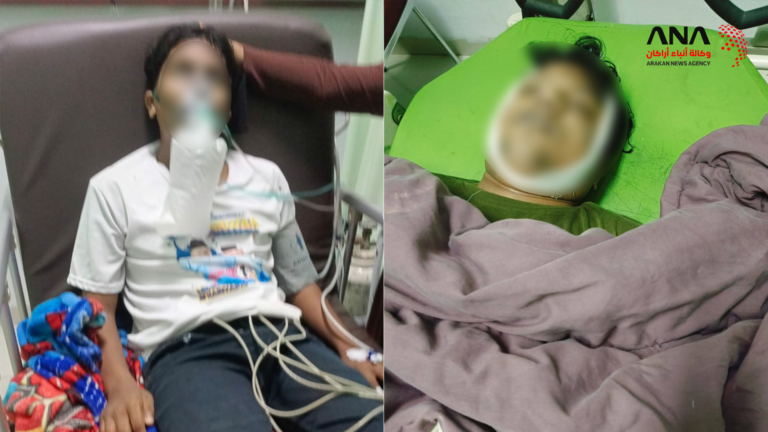 وفاة شابين من الروهينجا في إندونيسيا بسبب نقص الرعاية الطبية