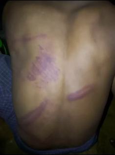 شرطة مزيفة تختطف لاجئين روهنجيين وتبتز أسرتيهما بمخيمات بنغلادش