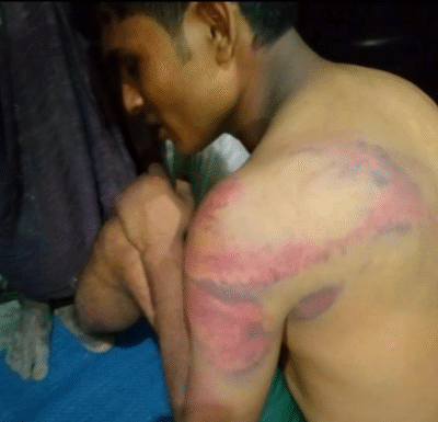 تعذيب شاب روهنجي بعد اختطافه مقابل فدية في مخيمات بنغلادش