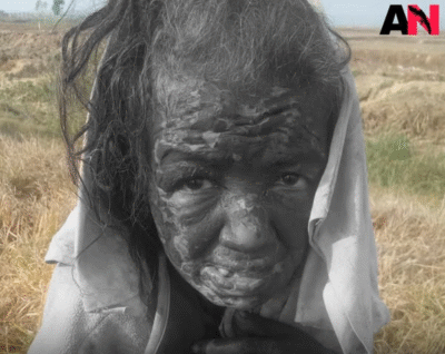 وفاة امرأة مريضة نفسياً بعد تعذيبها على يد جيش أراكان في بوثيدونغ
