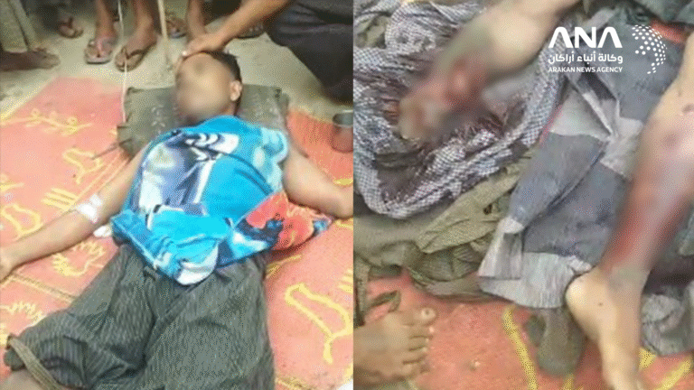 شاهد.. وفاة شاب روهنجي جراء انفجار لغم بمحيط مونغدو في أراكان