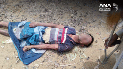 نجاة روهنجي من محاولة قتل على يد زوجته الثانية بمخيمات بنغلادش