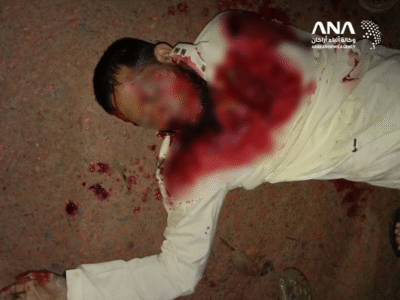 جثمان الشاب الروهنجي ضحية الاعتداء "حافظ مولفي محمد طاهر" (صورة: ANA)