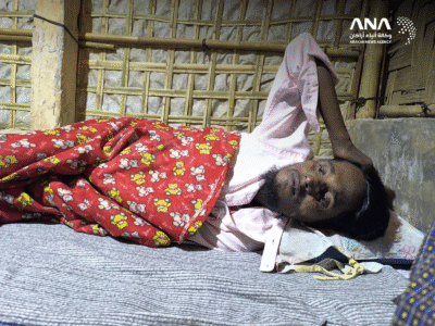 لاجئ روهنجي طريح الفراش جراء إصابته بأعراض الحمى الغامضة (صورة: ANA)