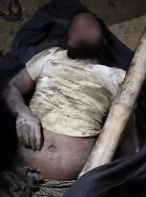 جماعة مسلحة تختطف 3 لاجئين روهنجيين من مخيمات بنغلادش 2 أحد المختطفين الروهينجا بعد إنقاذه وقبل نقله إلى المستشفى (صورة: مواقع التواصل الاجتماعي)