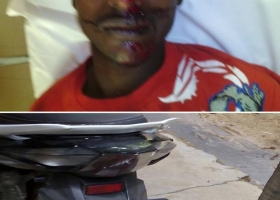 مجهولون يعتدون على شاب روهنجي في ماليزيا ويكسرون رجله